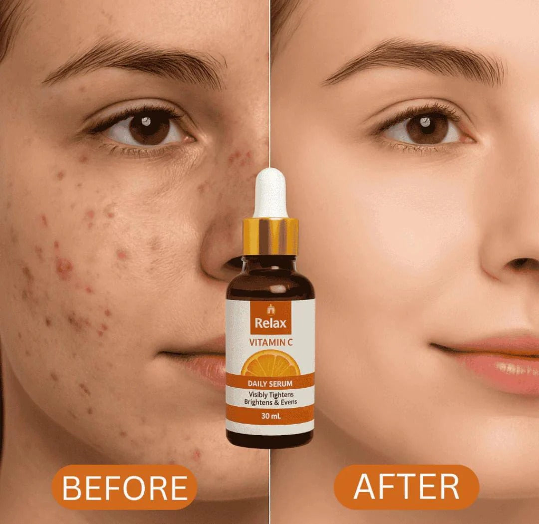 Relax Vitamin C Daily Face Serum – Brightening